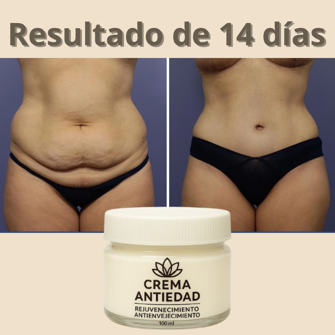 COMPRA 1 Y LLEVA 2 - Crema Rejuvenecedora y Anti-Envejecimiento - PAGUE AL RECIBIR