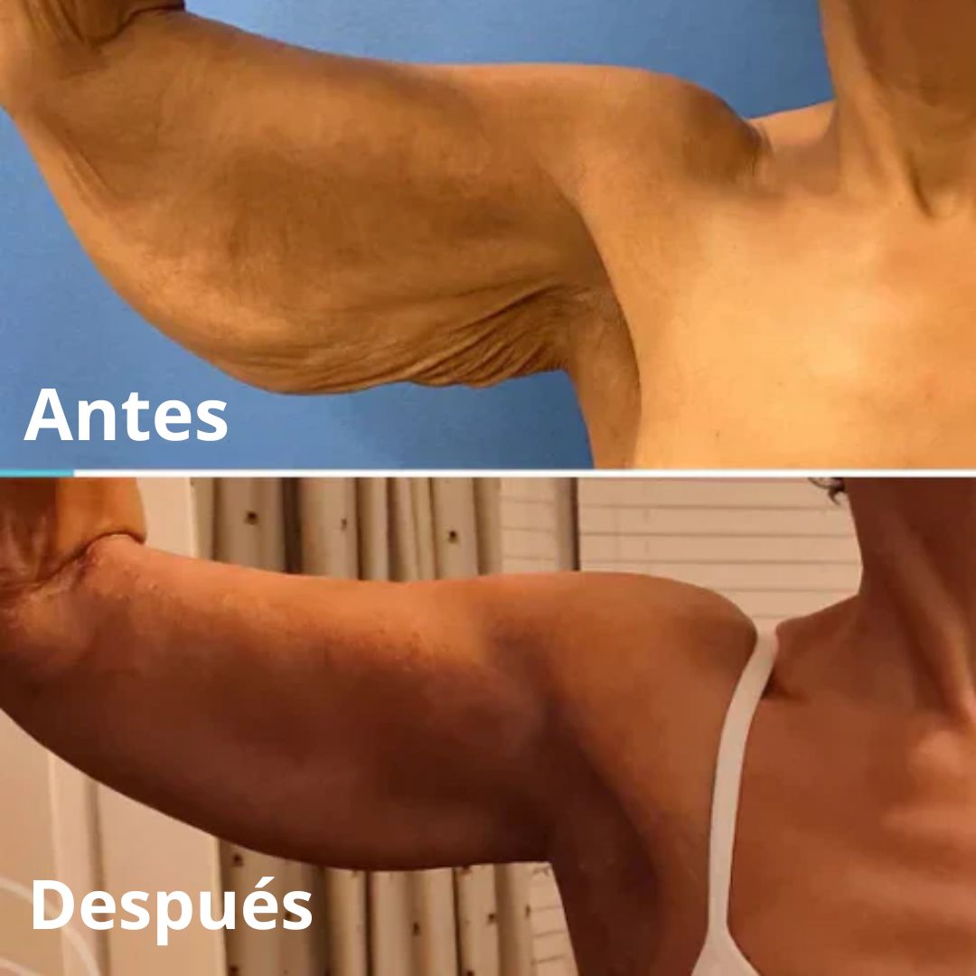 COMPRA 1 Y LLEVA 2 - Crema Rejuvenecedora y Anti-Envejecimiento - PAGUE AL RECIBIR