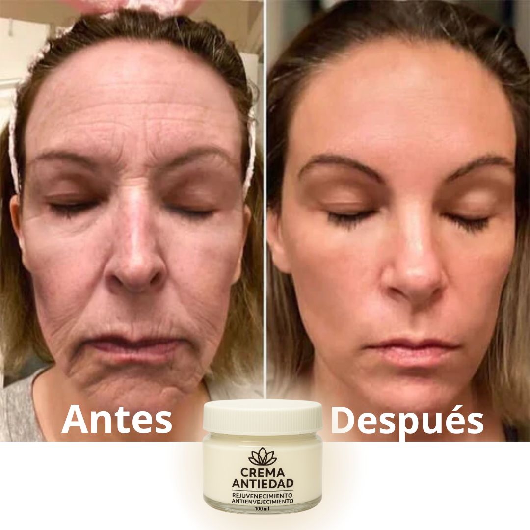 COMPRA 1 Y LLEVA 2 - Crema Rejuvenecedora y Anti-Envejecimiento - PAGUE AL RECIBIR