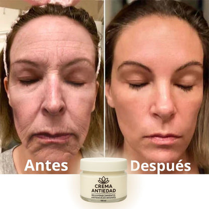 COMPRA 1 Y LLEVA 2 - Crema Rejuvenecedora y Anti-Envejecimiento - PAGUE AL RECIBIR